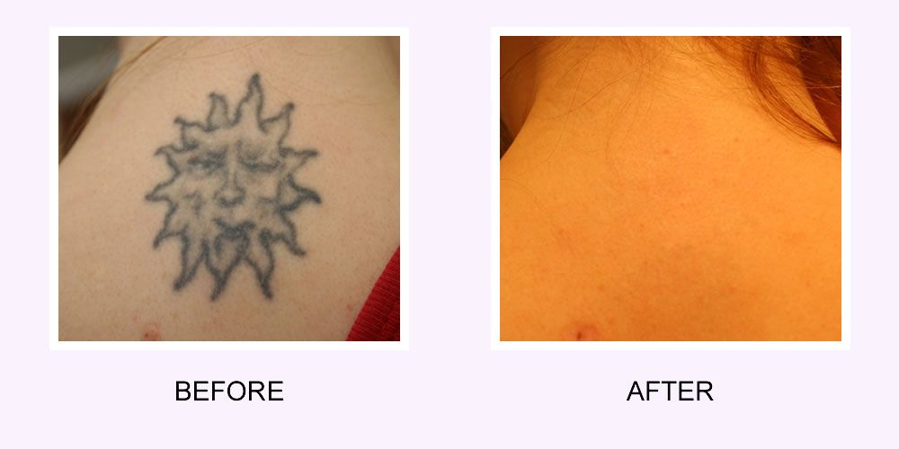 ABINGTON AESTHETIC & LASER MEDICAL CENTER Updated October 2024 16