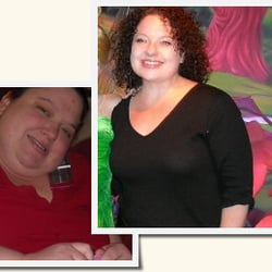 Weight Loss Specialists of North Texas - Rhonda - Roux-en-Y Gastric Bypass before and after