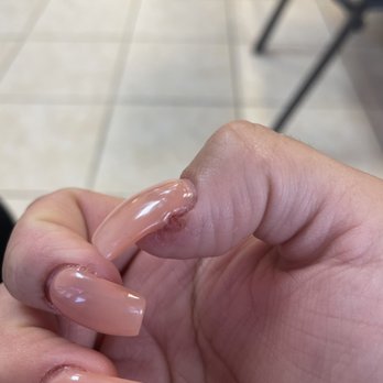 Blessing Nail 2 - Tech cut me and then put super glue on it. I stayed until done haha never ahain - Nail Salons Near Me - Apple Valley, California Blessing Nail 2 - Tech cut me and then put super glue on it. I stayed until done haha never ahain - Nail Salons Near Me - Apple Valley, California