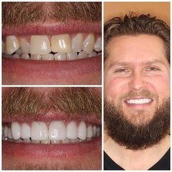 Simply Dental