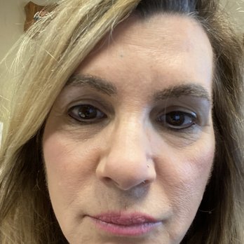 Timeless Skin Spa - After 6 days - Permanent Makeup Near Me - Los Gatos, California Timeless Skin Spa - After 6 days - Permanent Makeup Near Me - Los Gatos, California