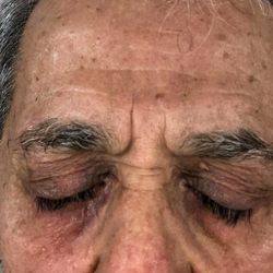 Ziyad Hammoudeh, MD - After