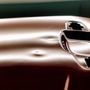 Photo of B Dentless LLC Paintless Dent Repair