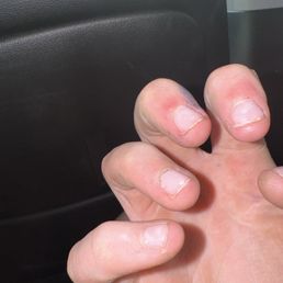 Clear gel that has been on for a month