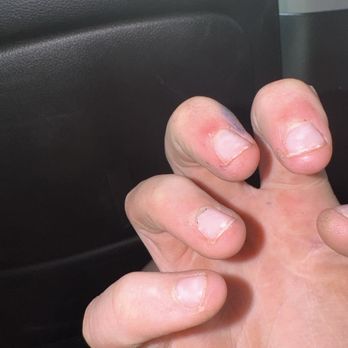 A+ Nails - Clear gel that has been on for a month - Nail Salons Near Me - Wilmington, North Carolina