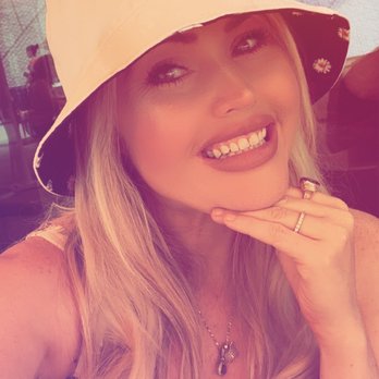 Anderson Dental - Royal Palm Beach - Me smiling - Cosmetic Dentists Near Me - Royal Palm Beach, Florida