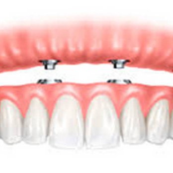 Neil A. Eisler, DMD - Eisler Dental - General Dentistry Near Me - Cresskill, New Jersey