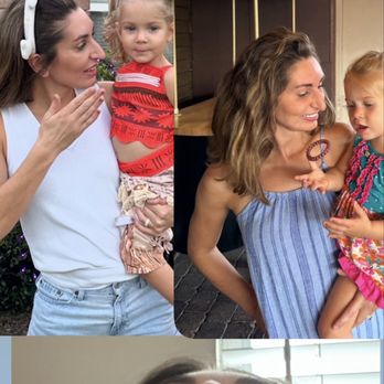 Fleming Island Plastic Surgery - Rhinoplasty results - Cosmetic Surgeons Near Me - Fleming Island, Florida Fleming Island Plastic Surgery - Rhinoplasty results - Cosmetic Surgeons Near Me - Fleming Island, Florida