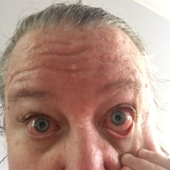 Cherry Lash - They kept getting more and more red and watery... - Eyelash Service Near Me - Las Vegas, Nevada