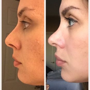 Edward H Park, MD - Cosmetic Surgeons Near Me - Upland, California