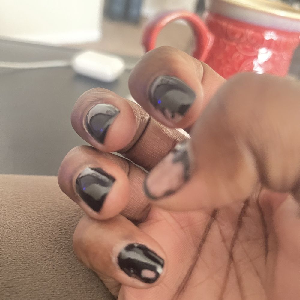 Right hand on the morning of the second day after my shower. Right hand on the morning of the second day after my shower.