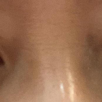 Shine Cosmetic Surgery - Cosmetic Surgeons Near Me - West Covina, California
