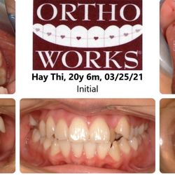 OrthoWorks - Before