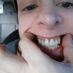 Somerset Dental Arts - Before