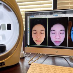 Pro Health Wellness Center & Spa - Skin Analysis - Results 2