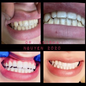 Thuận Nguyễn ANISHA NGUYEN, DDS - MILE SQUARE PARK FAMILY DENTAL GROUP