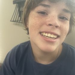 North Texas Orthodontic Associates - McKinney - Before and after braces
