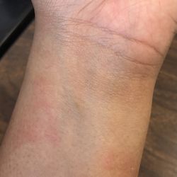 AutoZone - There is the scratch marks that I got on my arm along with other scratches that I got from having to get the nut out of the engine of my car