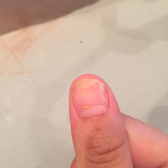 Cali Pro Nails - After taking my nails off I was left w fungus. This is an unsanitary place. - Nail Salons Near Me - Yuma, Arizona
