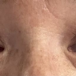 Lashes
