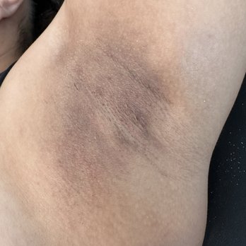 The Silk Room - After Picture - Underarm Wax - Waxing Near Me - Reno, Nevada The Silk Room - After Picture - Underarm Wax - Waxing Near Me - Reno, Nevada