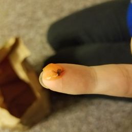 The fly that my girlfriend found in her fries.