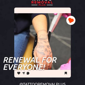 Tattoo Removal Plus - Renewal is an option for everyone. Because letting go of what no longer serves you is always in style. - Tattoo Removal Near Me - South Gate, California