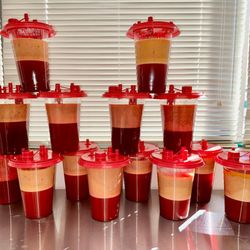 Premier Cosmetic Surgery & Medispa - Liposuction Cannisters (yellow layer is the fat, red layer is the numbing fluid injected during the procedure)