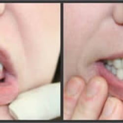 Premiere Dental of West Deptford
