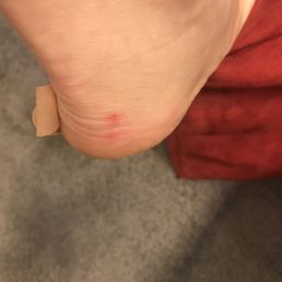 Painful heel , could barely wear shoes today