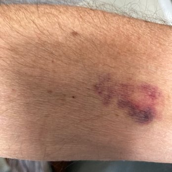 Harbor Medical Associates - this from getting blood test - Cardiologists Near Me - Weymouth, Massachusetts Harbor Medical Associates - this from getting blood test - Cardiologists Near Me - Weymouth, Massachusetts