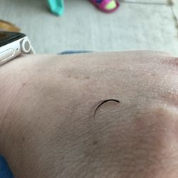 Lash fallout