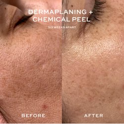 Skin By Women