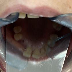 Mark Mancin, DDS - Before
