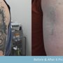 Andrea Catton Laser Clinic