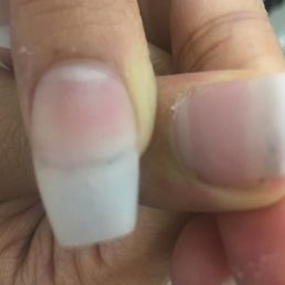 My nail after I rinsed off the blood. My nail after I rinsed off the blood.