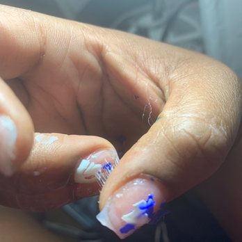 New Look Nails - Mma toxic fake acrylic used at this location, Real acrylic does not soak off like this - Nail Salons Near Me - Baldwin, New York New Look Nails - Mma toxic fake acrylic used at this location, Real acrylic does not soak off like this - Nail Salons Near Me - Baldwin, New York