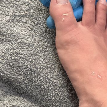 Glamour Nails & Spa - Big ingrown nail - Nail Salons Near Me - Norco, California
