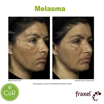 CüR Laser and Skin - Skin Care Near Me - Vancouver, British Columbia