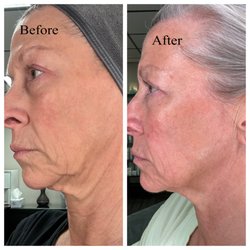 Curative Skin Therapies