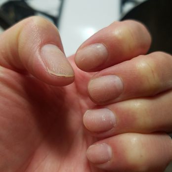 Lux Nail Spa - NAIL DISASTER - Nail Salons Near Me - Redondo Beach, California Lux Nail Spa - NAIL DISASTER - Nail Salons Near Me - Redondo Beach, California