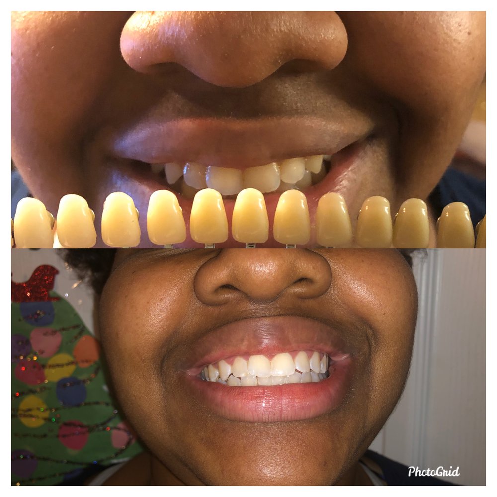 RADIANCE BEAUTY LAB Westfield, New Jersey Teeth Whitening Phone Number Yelp