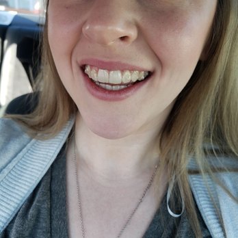 White Rock Orthodontics - 9 months in!! - Orthodontists Near Me - Dallas, Texas