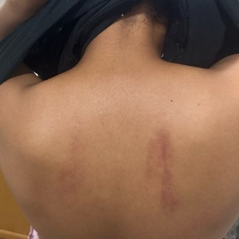 Massage Express - My back is bruised and in pain now. I thought a massage should be relaxing? - Massage Near Me - Salisbury, Maryland Massage Express - My back is bruised and in pain now. I thought a massage should be relaxing? - Massage Near Me - Salisbury, Maryland