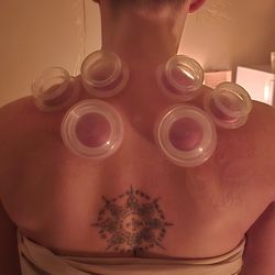 Fairbanks Massage & Bodywork - Trying different cupping techniques.
