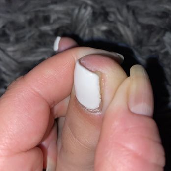 Vida Nail Spa - Green ooz from infection - Nail Salons Near Me - Oakley, California Vida Nail Spa - Green ooz from infection - Nail Salons Near Me - Oakley, California