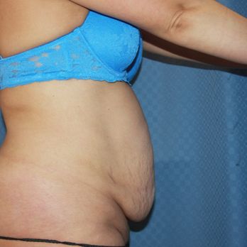 Dr K Plastic Surgery Orange County - Cosmetic Surgeons Near Me - Irvine, California Dr K Plastic Surgery Orange County - Cosmetic Surgeons Near Me - Irvine, California