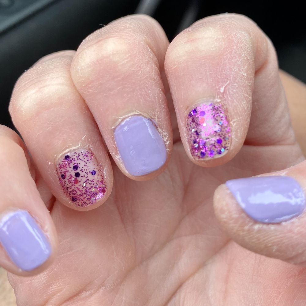 Dry uncut cuticles Dry uncut cuticles