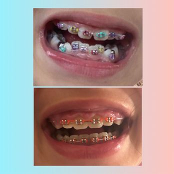 Matthew Ronconi Orthodontics - Excellent Doctor 100% recomended - Orthodontists Near Me - Salinas, California