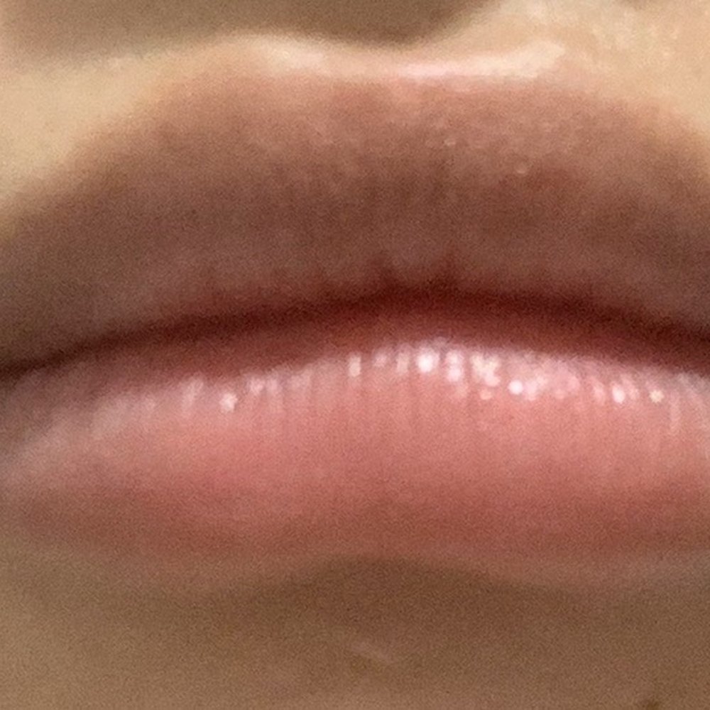 Ego - Body Contouring Near Me - Modesto, California